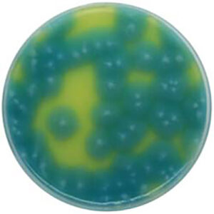 Bacillus Cereus Agar base
